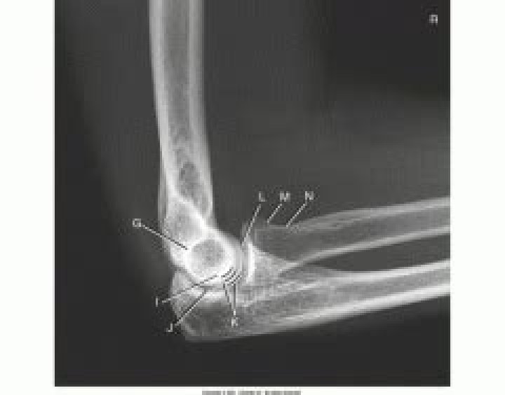 AP forearm x-ray labeling anatomy Quiz