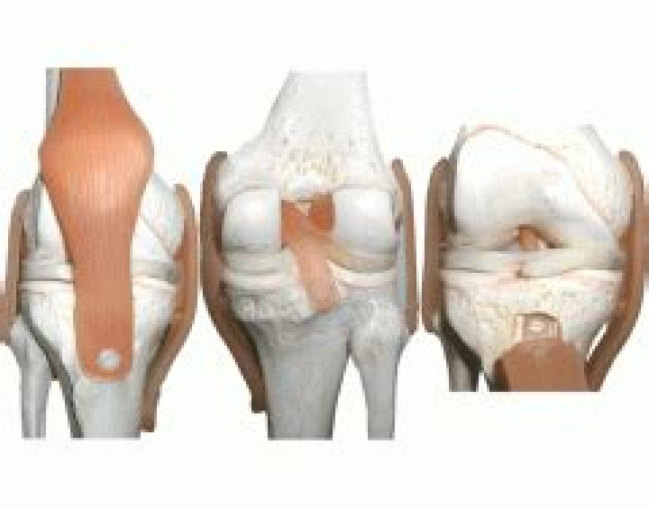 Knee Joint Model Labeling Quiz