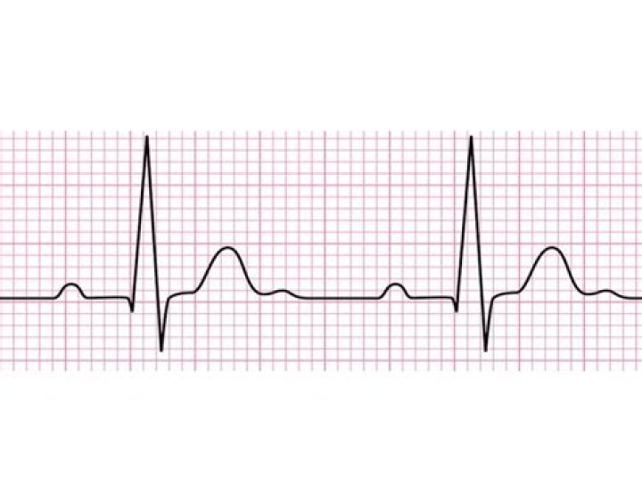 Label the EKG/ECG — Printable Worksheet
