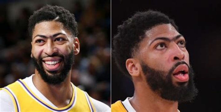 Lakers’ Anthony Davis Undergoes Crazy Body Transformation (Photos)